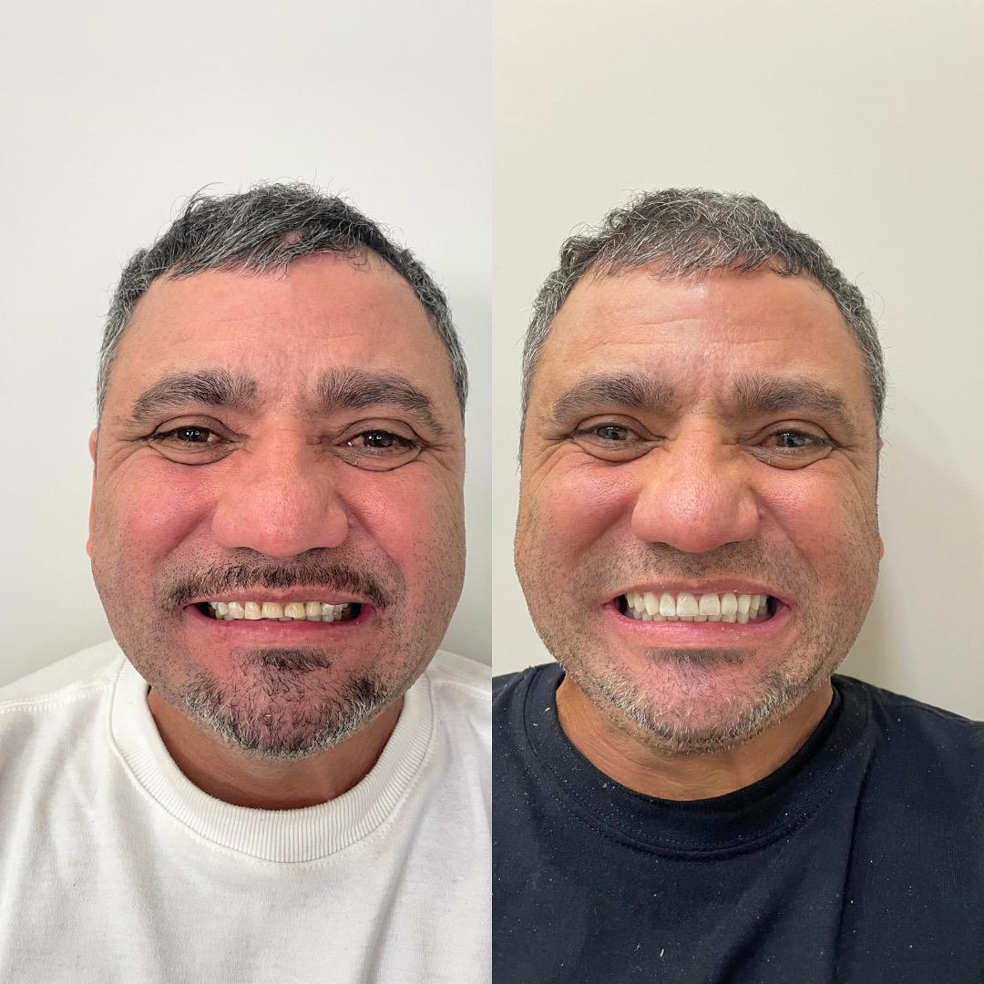 Antes e depois - Roberto