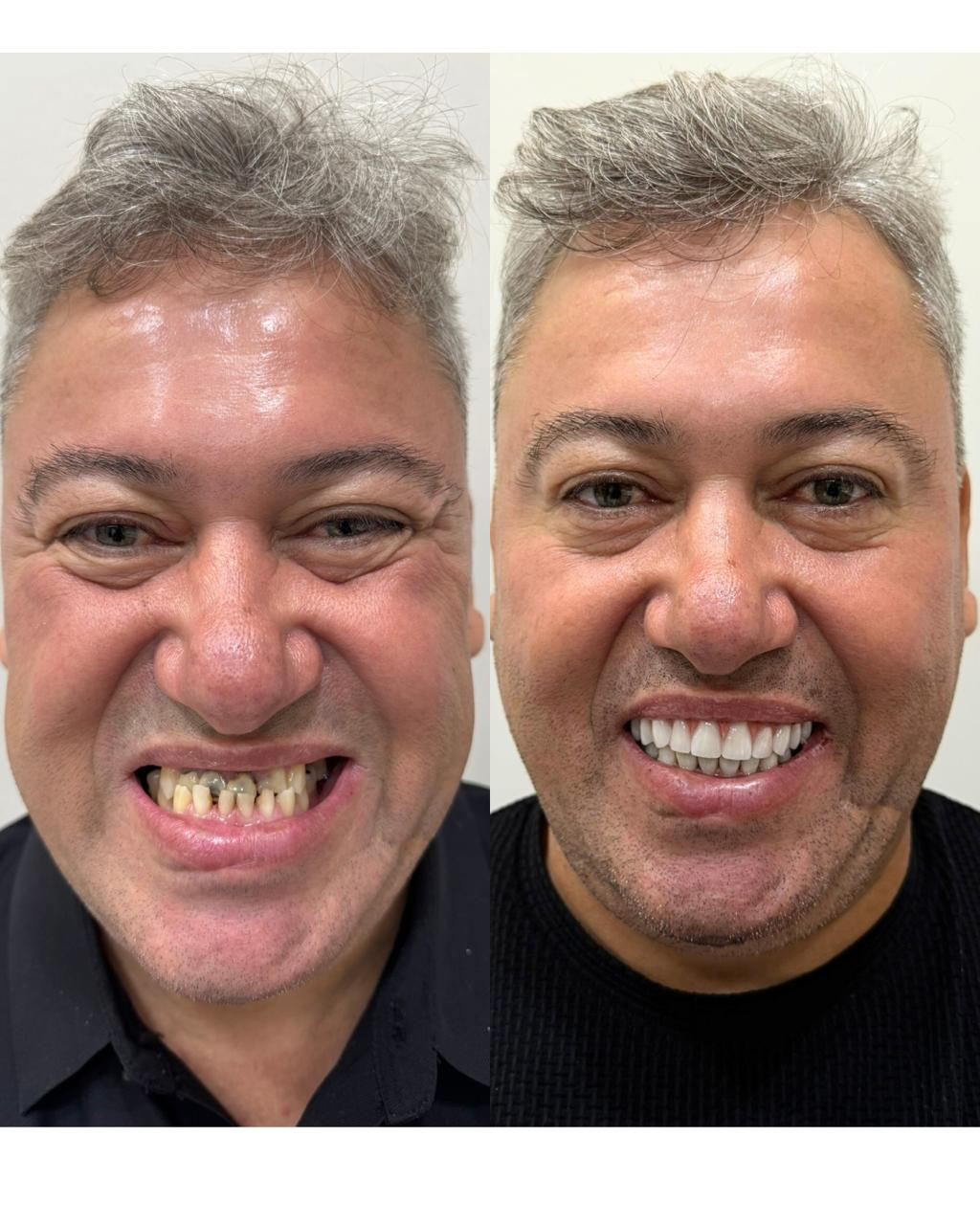 Antes e depois - José